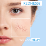 REDNESS CALM Correcting day cream RGB_1